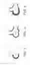 Fig. 02 - Ceramic-backed elbow