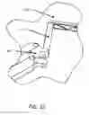 Fig. 07 - VEST-MOUNTED GIMBAL SUPPORT, AND A METHOD FOR ITS USE