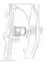 Fig. 09 - Noise suppressor for firearms