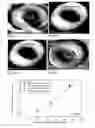 Fig. 08 - ASSESSMENT OF RISK OF HYPERTENSION AND METHODS BASED THEREON
