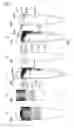Fig. 07 - Linear movement type reaction treatment apparatus and method thereof