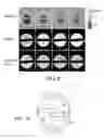 Fig. 07 - Method of MRI imaging using a spectrally designed pulse