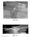 Fig. 09 - Discrete coating of liquid on a liquid-coated substrate and use in forming laminates