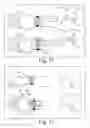 Fig. 17 - Wearable computing devices and methods for the wrist and/or forearm
