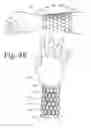 Fig. 52 - Wearable computing devices and methods for the wrist and/or forearm