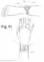 Fig. 55 - Wearable computing devices and methods for the wrist and/or forearm