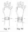 Fig. 61 - Wearable computing devices and methods for the wrist and/or forearm