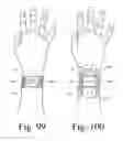 Fig. 62 - Wearable computing devices and methods for the wrist and/or forearm