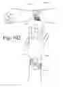 Fig. 64 - Wearable computing devices and methods for the wrist and/or forearm