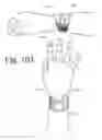 Fig. 65 - Wearable computing devices and methods for the wrist and/or forearm
