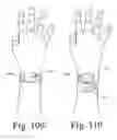 Fig. 68 - Wearable computing devices and methods for the wrist and/or forearm