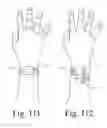 Fig. 69 - Wearable computing devices and methods for the wrist and/or forearm
