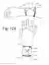Fig. 78 - Wearable computing devices and methods for the wrist and/or forearm