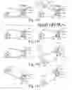 Fig. 87 - Wearable computing devices and methods for the wrist and/or forearm