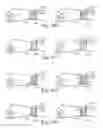 Fig. 90 - Wearable computing devices and methods for the wrist and/or forearm