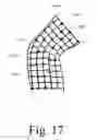 Fig. 17 - Motion recognition clothing [TM] with flexible electromagnetic, light, or sonic energy pathways
