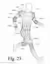 Fig. 23 - Motion recognition clothing [TM] with flexible electromagnetic, light, or sonic energy pathways