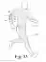 Fig. 33 - Motion recognition clothing [TM] with flexible electromagnetic, light, or sonic energy pathways
