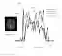 Fig. 07 - System, method and computer-accessible medium for joint magnetic resonance-positron emission tomography reconstruction using multi-sensor compressed sensing