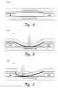 Fig. 04 - Pressure sensitive key normalization
