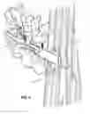 Fig. 03 - Hunting Blind