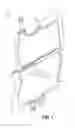 Fig. 02 - SOLUTION FOR PRESERVING VASCULAR CONDUITS