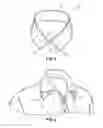 Fig. 02 - Collar Shaping Device