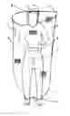 Fig. 01 - Insect Protection Garment