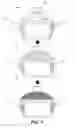 Fig. 02 - CLICK AND LOCK COOKWARE HANDLES