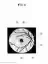 Fig. 09 - Fundus imaging apparatus that determines a state of alignment