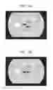 Fig. 07 - Ophthalmologic apparatus and control method therefor