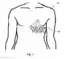 Fig. 08 - Wearable Device and Method for Assessing Cardiac Wellness by Analyzing High Definition EKG Signals