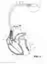 Fig. 03 - Cardiac resynchronization system and method