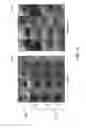 Fig. 16 - ELECTROMAGNETIC SENSOR INTEGRATION WITH ULTRATHIN SCANNING FIBER ENDOSCOPE
