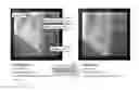 Fig. 01 - Regression for periodic phase-dependent modeling in angiography