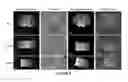 Fig. 08 - Systems, methods and computer readable storage media storing instructions for generating planning images based on HDR applicators