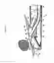 Fig. 02 - Tissue sampling device