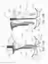 Fig. 20 - Needle and snare guide apparatus for passing suture
