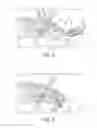 Fig. 04 - Swivel anchor for knotless fixation of tissue