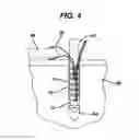 Fig. 04 - Knotless suture anchor