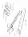 Fig. 258 - Stapling system comprising implantable layers