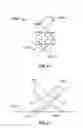 Fig. 06 - Anastomosis Devices