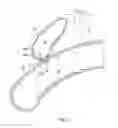 Fig. 02 - Anastomosis devices