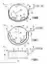 Fig. 28 - Noninvasive protection from emboli