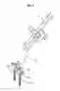 Fig. 08 - System for partially cutting a bone