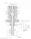 Fig. 03 - UNDERCUTTING BONE DRILLS AND METHODS OF USE