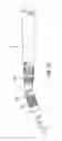 Fig. 17 - Rotary tool with improved coupling assembly