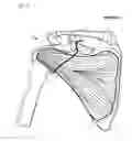 Fig. 04 - Method of humeral head resurfacing and/or replacement and system for accomplishing the method