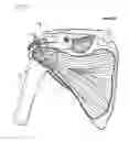 Fig. 06 - Method of humeral head resurfacing and/or replacement and system for accomplishing the method