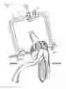 Fig. 10 - Method of humeral head resurfacing and/or replacement and system for accomplishing the method